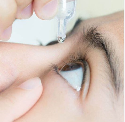 Kuru Göz Sendromu - İdeal Göz Kayseri