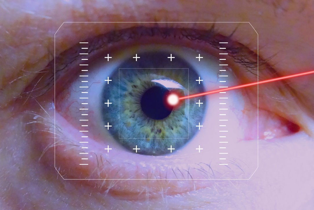 femto lasik