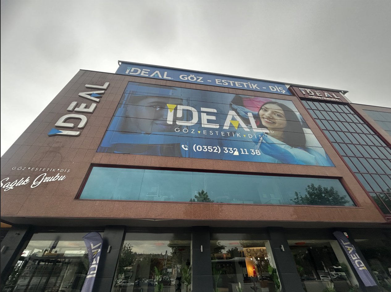 Göz doktoru idealgöz kayseri